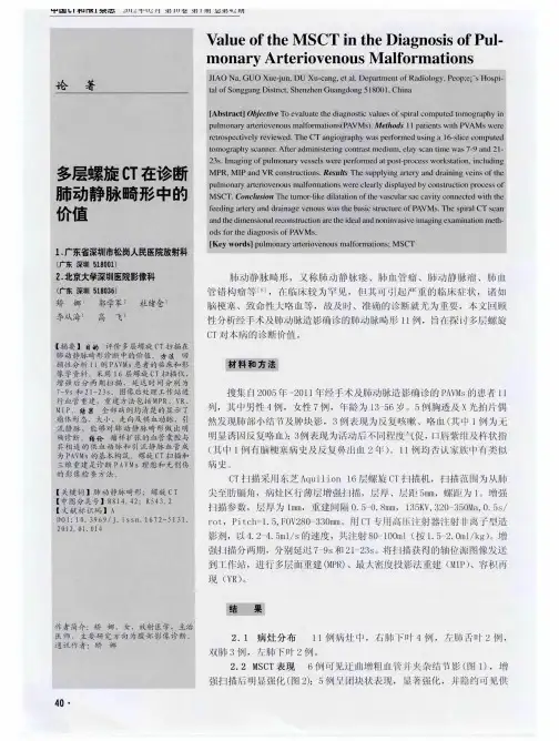 多层螺旋CT在诊断肺动静脉畸形中的价值