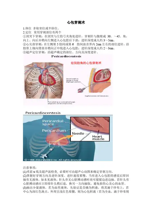 心内常用穿刺术