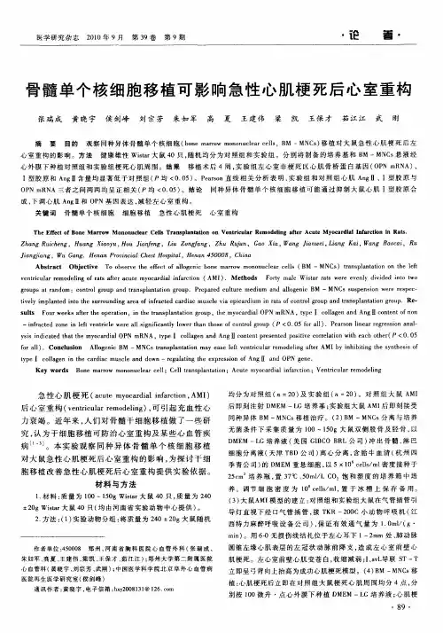 骨髓单个核细胞移植可影响急性心肌梗死后心室重构