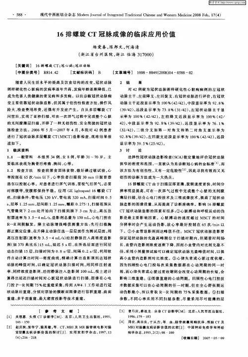 16排螺旋CT冠脉成像的临床应用价值