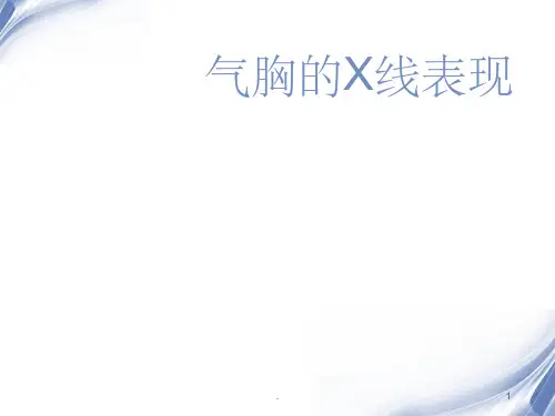 气胸的X线表现PPT课件