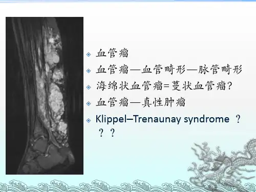 脉管畸形影像表现