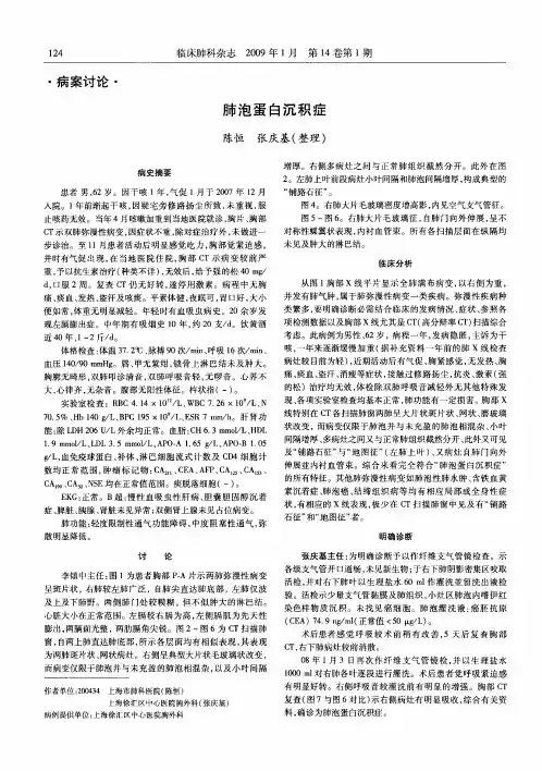 肺泡蛋白沉积症 2