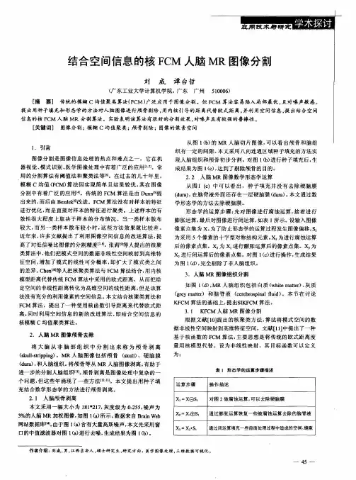 结合空间信息的核FCM人脑MR图像分割