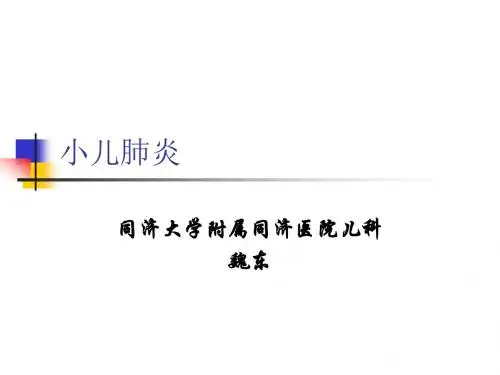 小儿肺炎