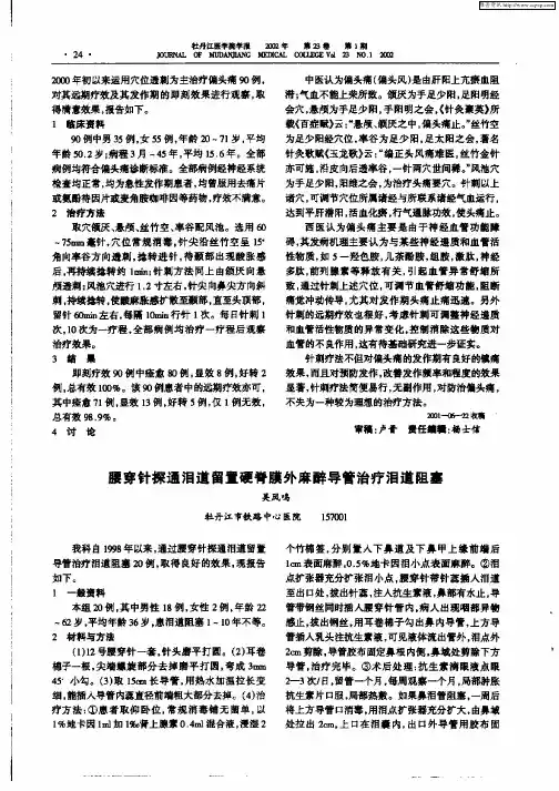 腰穿针探通钼道留置硬脊膜外麻醉导管治疗泪道阻塞