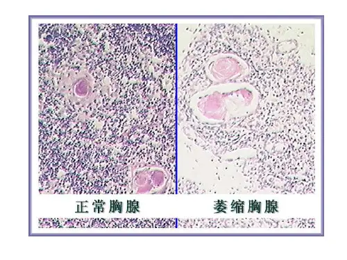 病理读片讨论