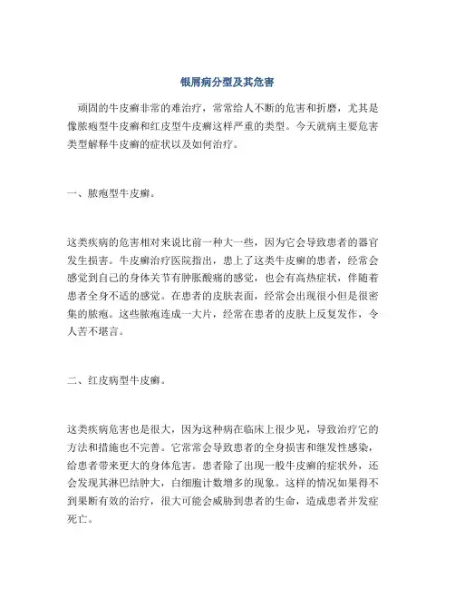 银屑病分型及其危害