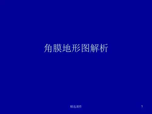 角膜地形图解析0589