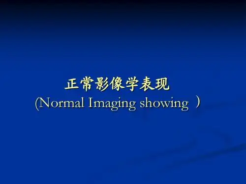胸部影像解剖
