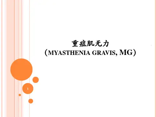 重症肌无力 