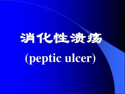 消化性溃疡