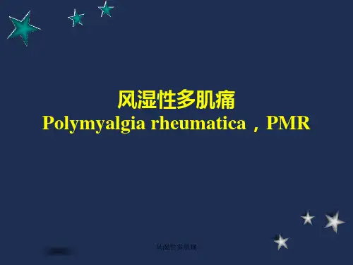 风湿性多肌痛 ppt课件