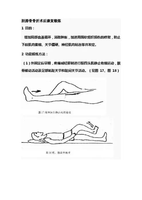 胫腓骨骨折术后康复锻炼