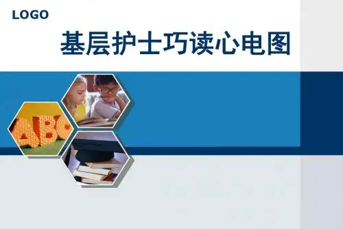 识别心电图