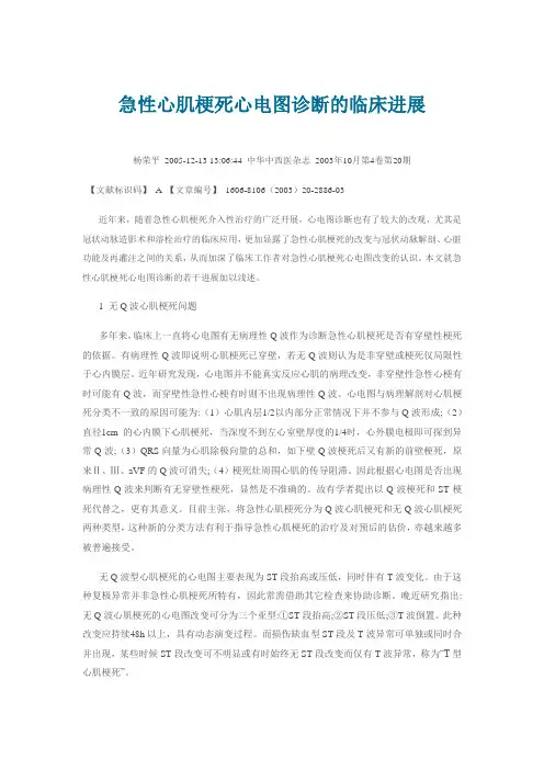 急性心肌梗死心电图诊断的临床进展