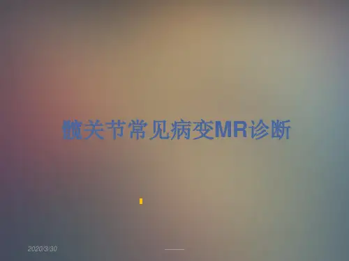 髋关节常见病变MR诊断