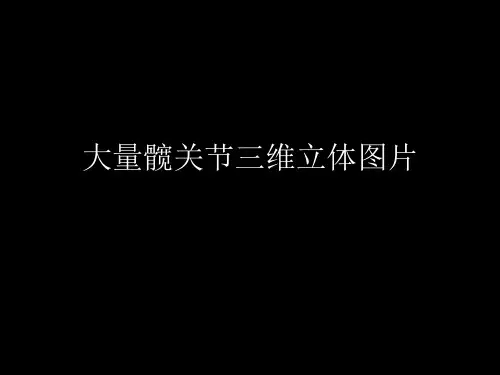 大量髋关节三维立体图片