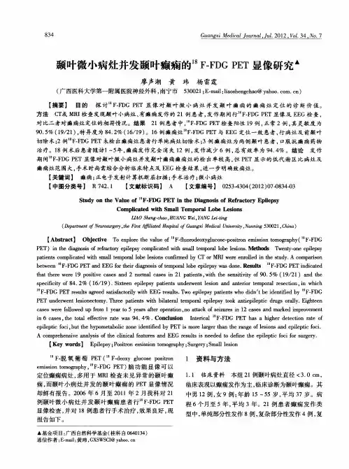 颞叶微小病灶并发颞叶癫痫的 18F-FDG PET显像研究