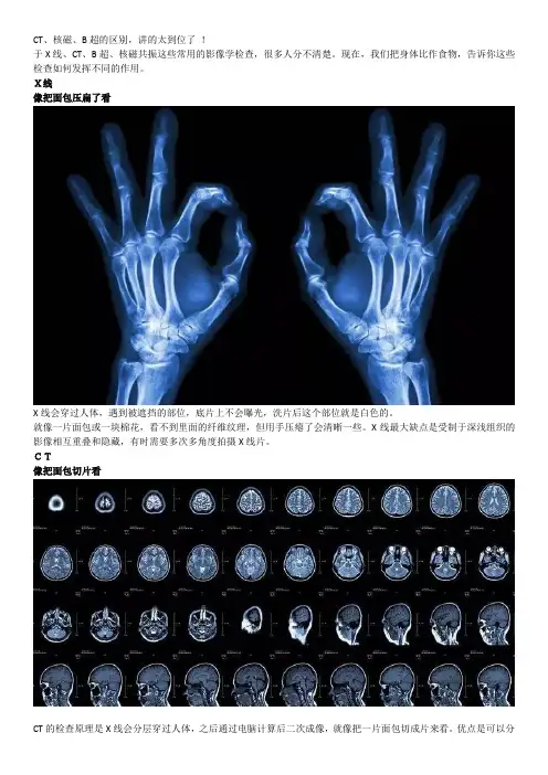 CT、核磁、B超的区别,讲的太到位了