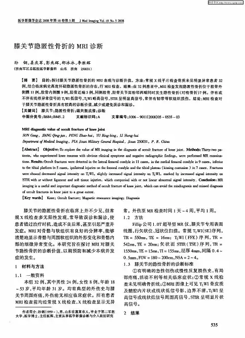 膝关节隐匿性骨折的MRI诊断