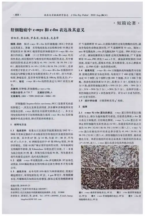 肝细胞癌中c-myc和c-fos表达及其意义