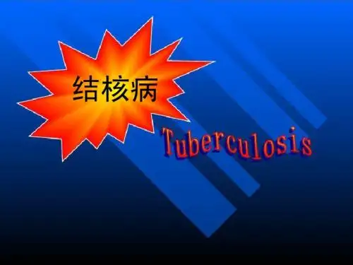 细菌性传染病:结核病