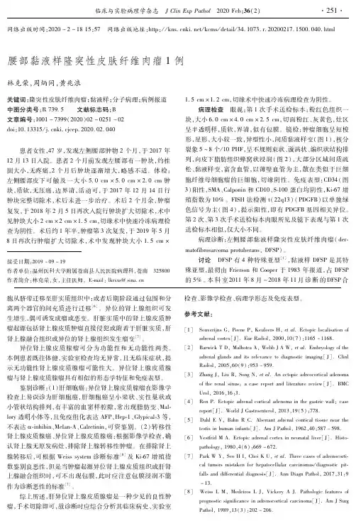 腰部黏液样隆突性皮肤纤维肉瘤1例