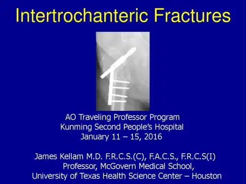 IT fractures UBC04032014final