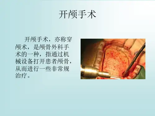 开颅手术
