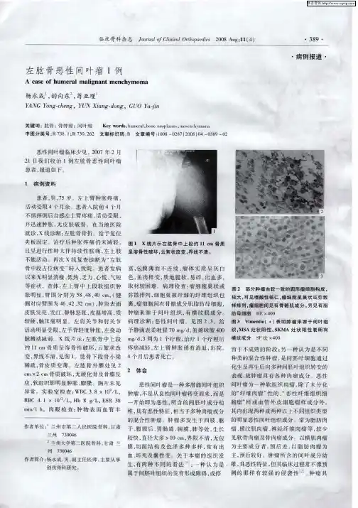 左肱骨恶性间叶瘤1例