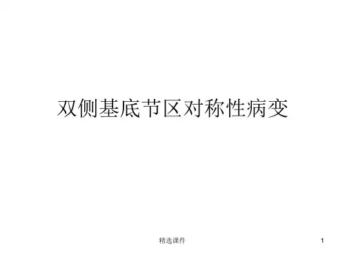 双侧基底节区对称性病变