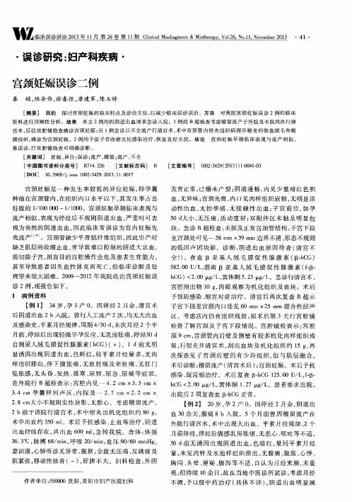 宫颈妊娠误诊二例