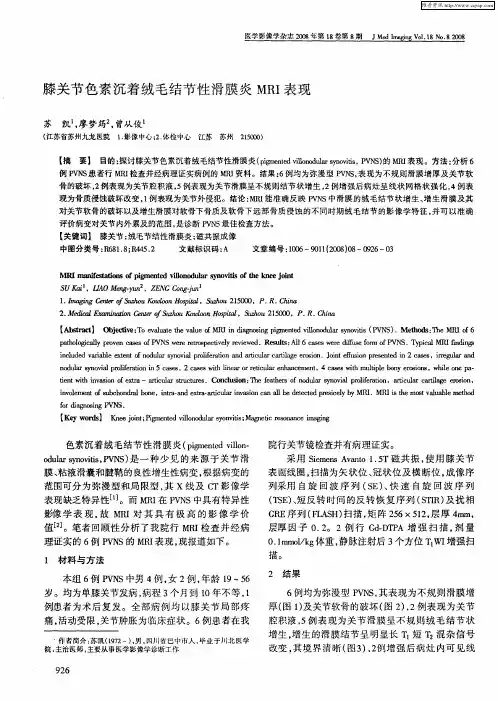 膝关节色素沉着绒毛结节性滑膜炎MRI表现