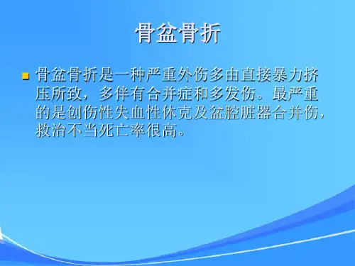 骨盆骨折护理业务查房