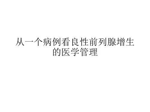 从一个病例来看良性前列腺增生的医学管理