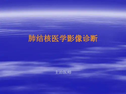 肺结核影像诊断2017