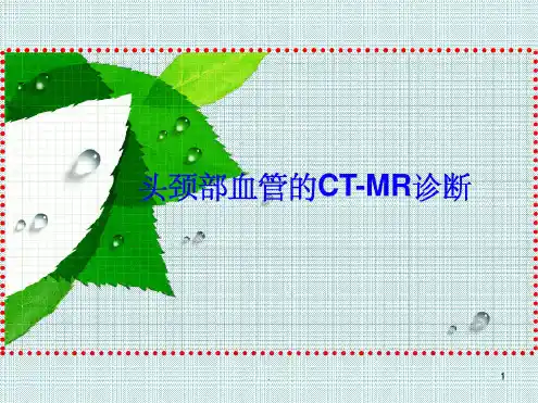 头颈部血管的ct-mr诊断