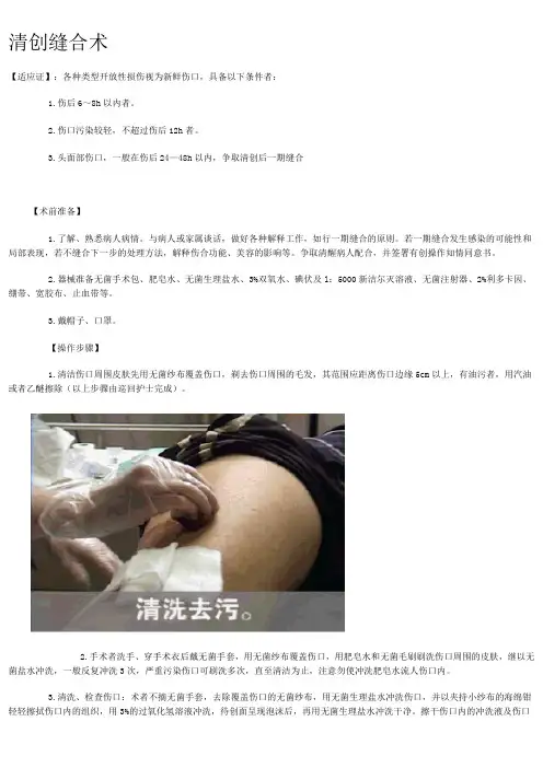 清创缝合术