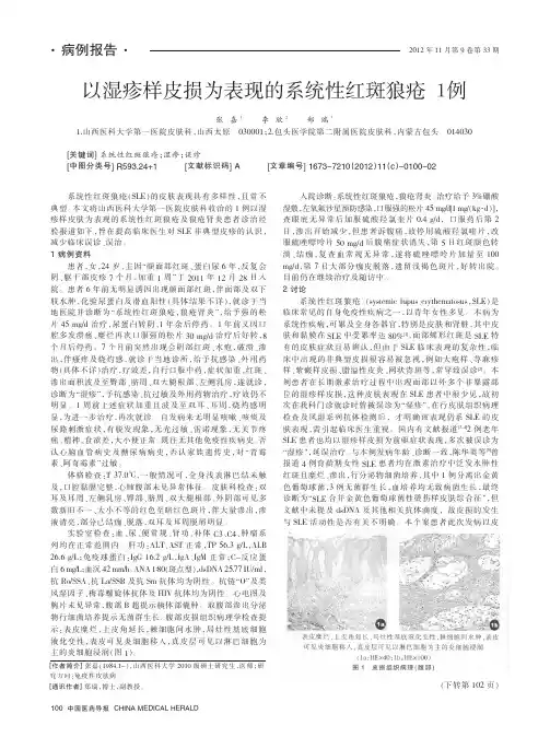以湿疹样皮损为表现的系统性红斑狼疮1例