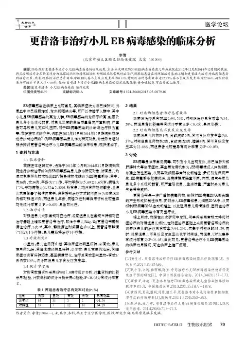 更昔洛韦治疗小儿EB病毒感染的临床分析