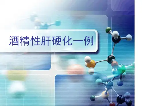 病例分析：酒精性肝病一例-