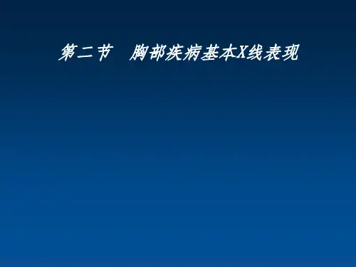 胸部疾病基本X线表现ppt课件