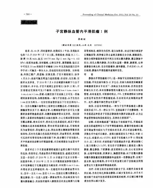 子宫静脉血管内平滑肌瘤1例