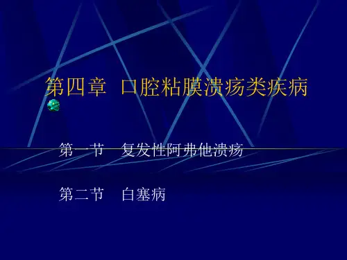 口腔溃疡PPT课件
