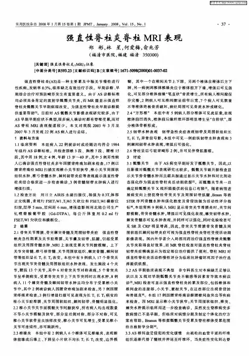 强直性脊柱炎脊柱MRI表现