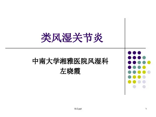 类风湿关节炎PPT课件PPT课件