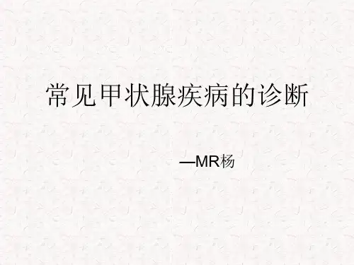 常见甲状腺疾病的CT诊断总结