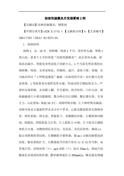结核性脑膜炎并发烟雾病2例