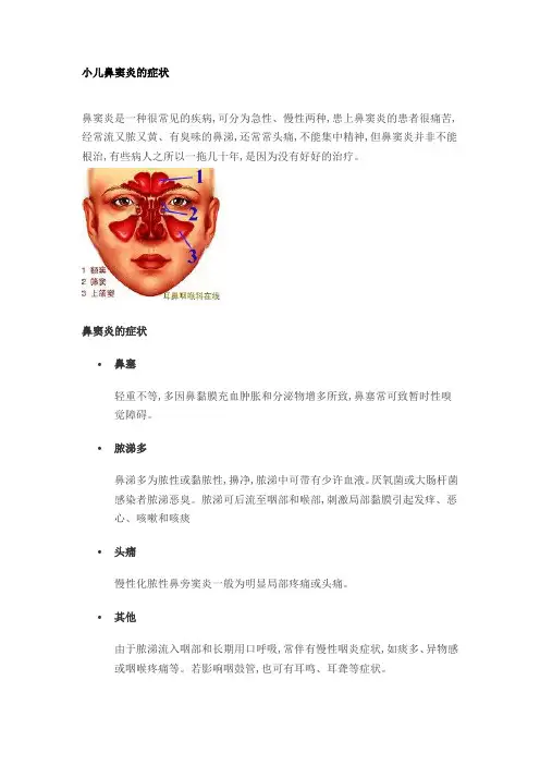 小儿鼻窦炎的症状